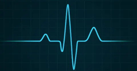 Illustration of a pulse waveform on a graph